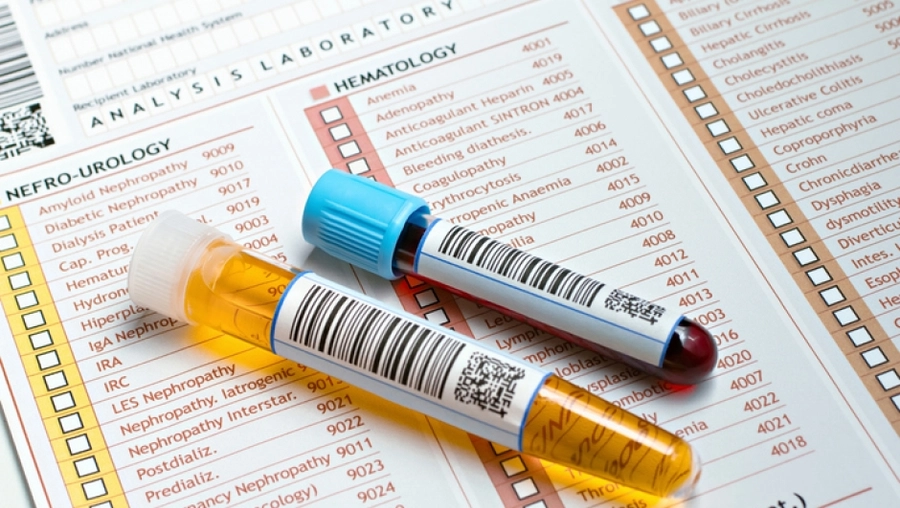 Tumoret e fshikëzës: lamtumirë cistoskopisë? Një test i bërë në shtëpi zbulon 9 raste në 10