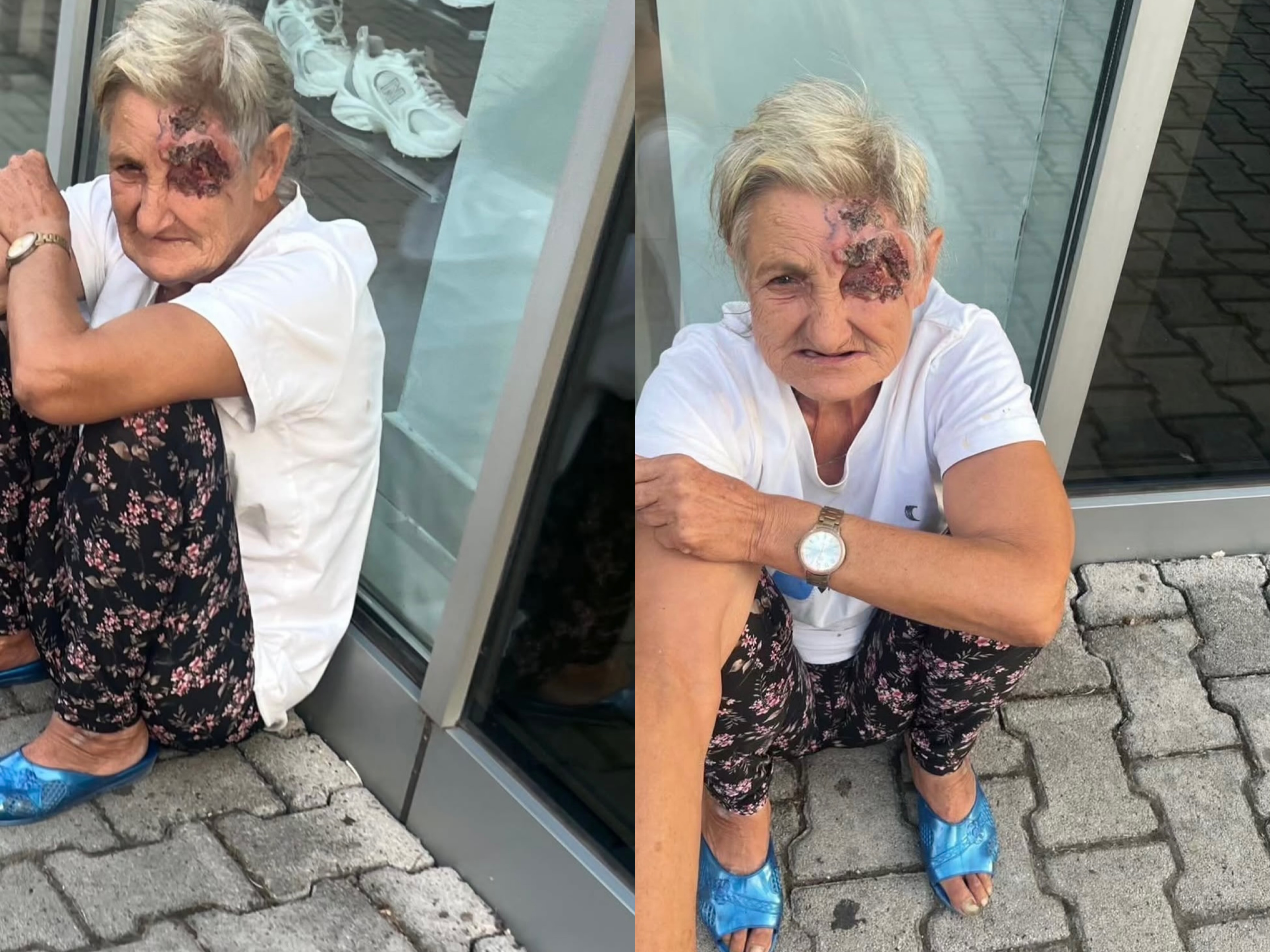 “S’kam para të kurohem”, gruaja e sëmurë në Elbasan ka nevojë për ndihmë