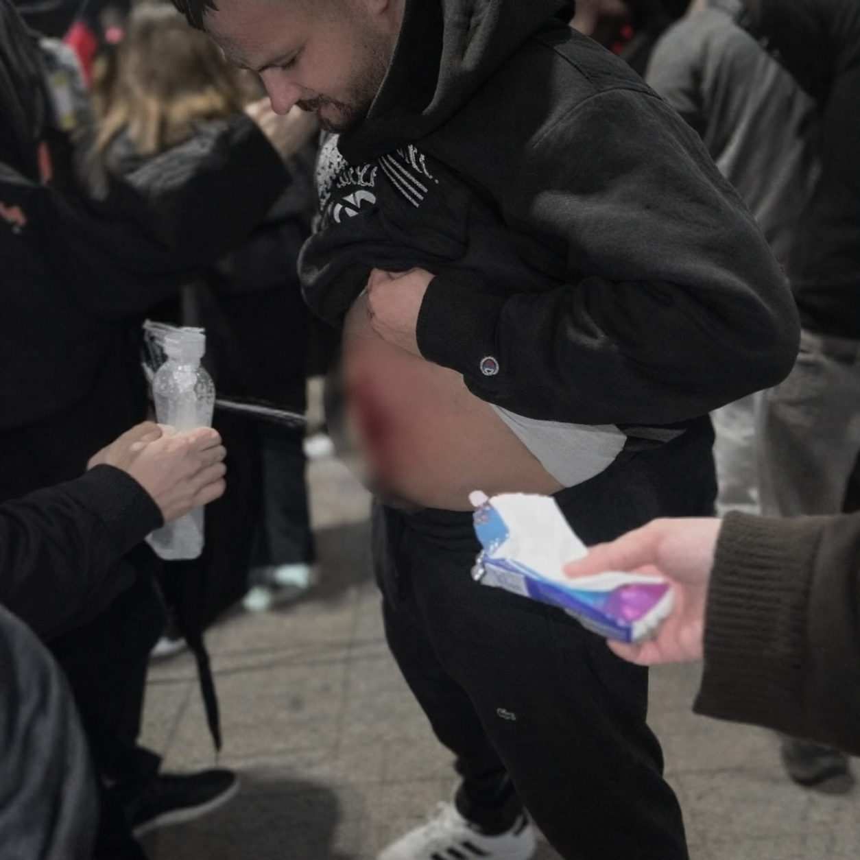 I riu plagoset me plumb gome në bark gjatë protestës, dërgohet me urgjencë te Trauma