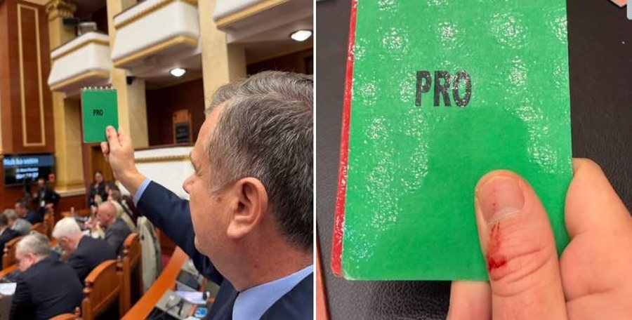 Me gishtin e gjakosur, Balla i përgjigjet Berishës: 100 mijë lekë për kokë maskave për dhunë