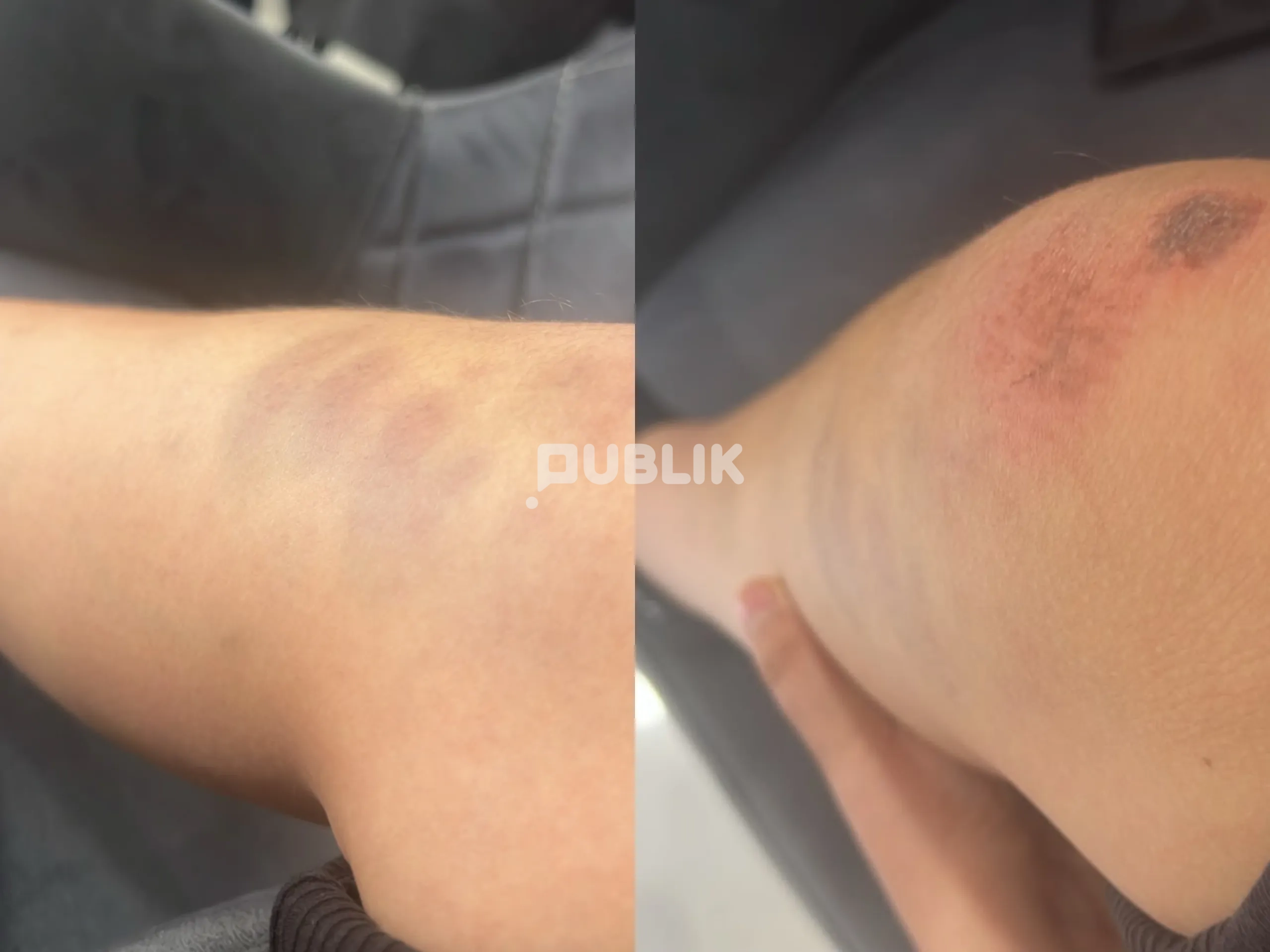 Denoncimi i 13-vjeçarit: Policët më rrahën, më shanë dhe më grisën librat
