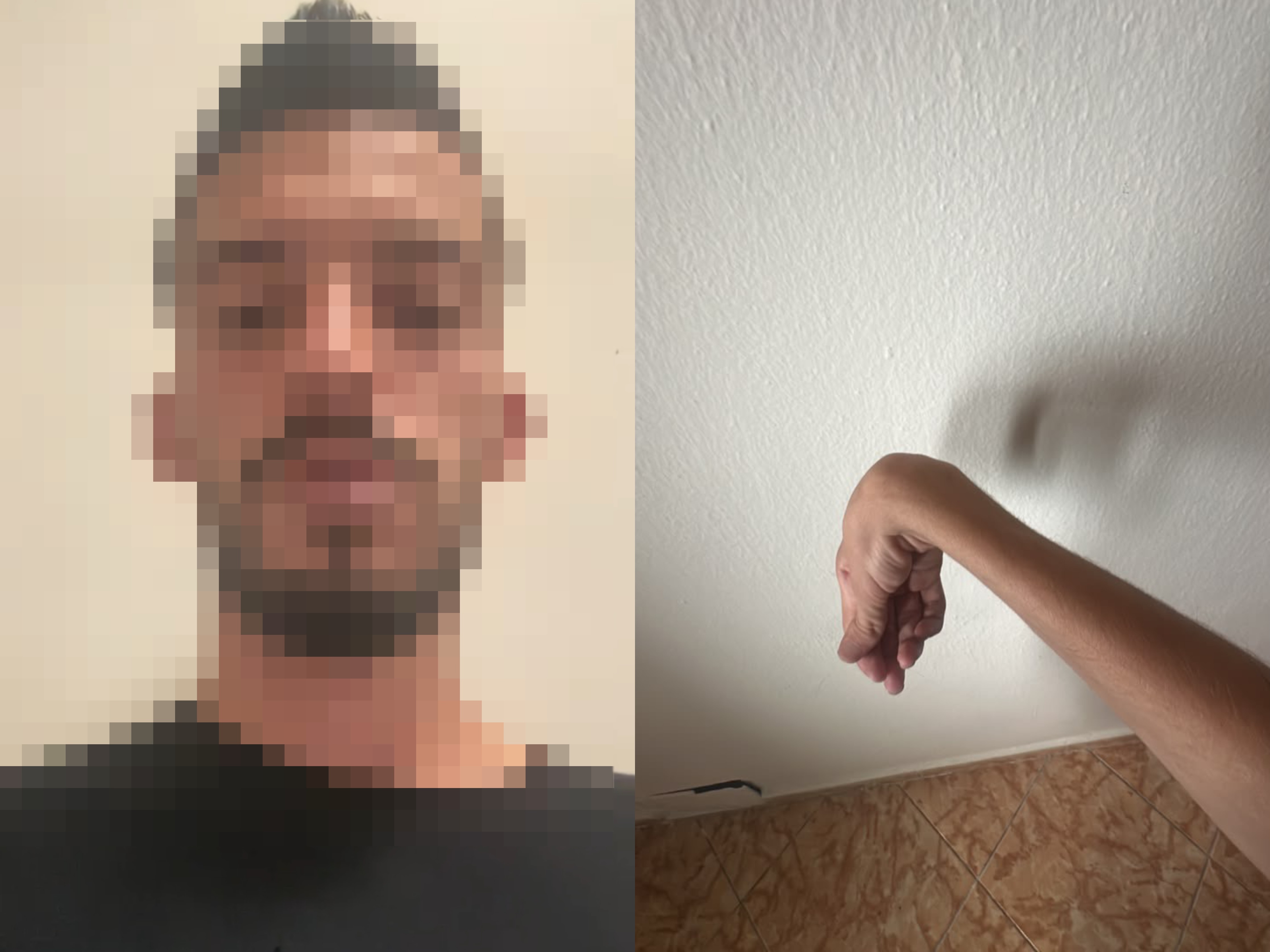25-vjeçari nga Vora, i paralizuar në krahun e djathtë që në fëmijëri, kërkon punë