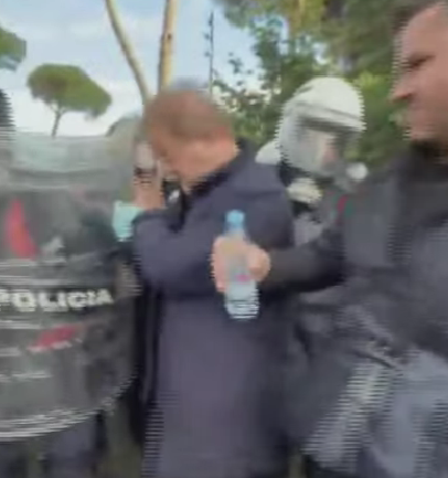 Spraj djegës gjatë protestës, deputeti i PD-së dërgohet me urgjencë në spital