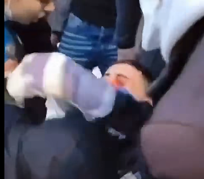 Pamje të rënda nga protesta, i riu me gjakderdhje në sy pas goditjes me plumb gome