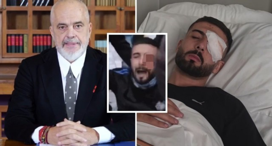 Motra e Erjonit demaskon mashtrimet e Ramës për kurimin: Janë të gjitha mashtrime…nuk e ka dërguar shteti, por familja