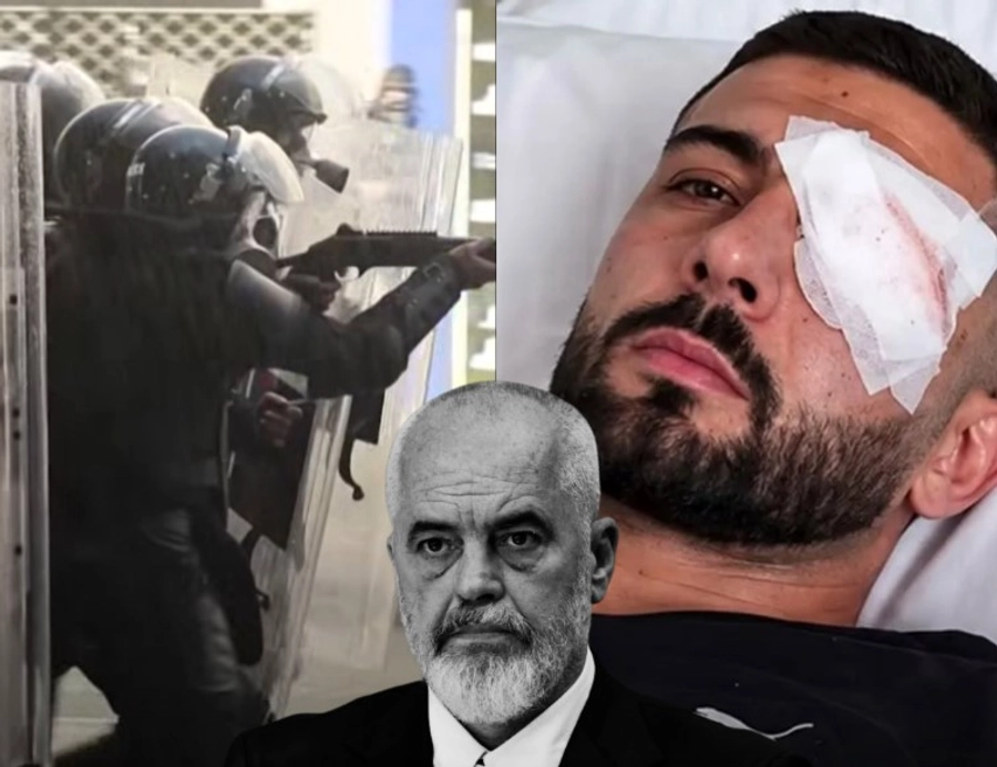 U godit nga policia me plumb gome në sy/ Demokratët Evropianë 'shuplakë' Ramës: Promovim politik në kurriz të Erjonit
