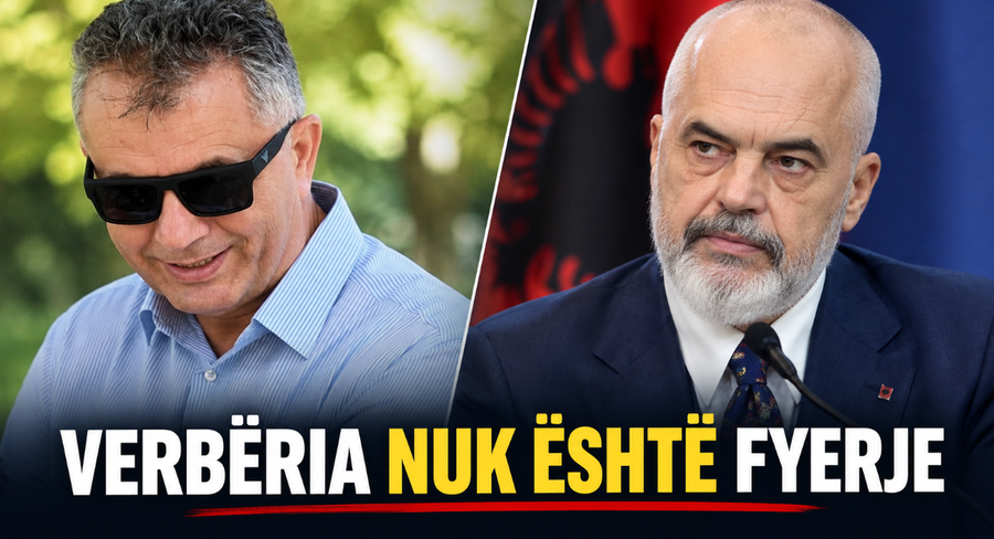 'U bëfsh njëri prej nesh', i verbëri mesazh për Ramën: Nuk është mallkim, por bekim